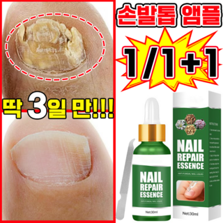 [네일케어] 발톱 앰플 발톱 곰팡이 솔루션 문제성발톱 앰플 한번에끝내는 손발톱 영양제, 2개, 30ml