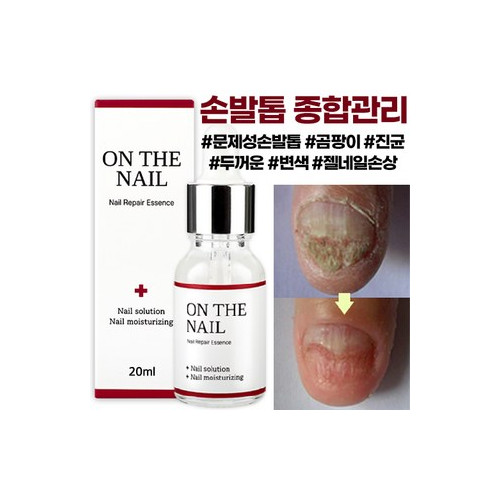 비비룩 온더네일 에센스, 20ml, 1개